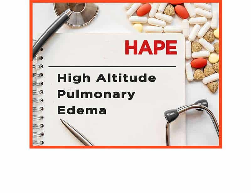 High altitude pulmonary edema (hape)