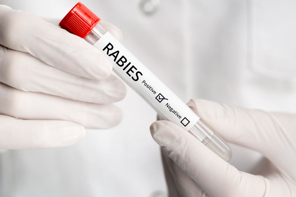 実験技師が狂犬病の血液サンプルを持っている