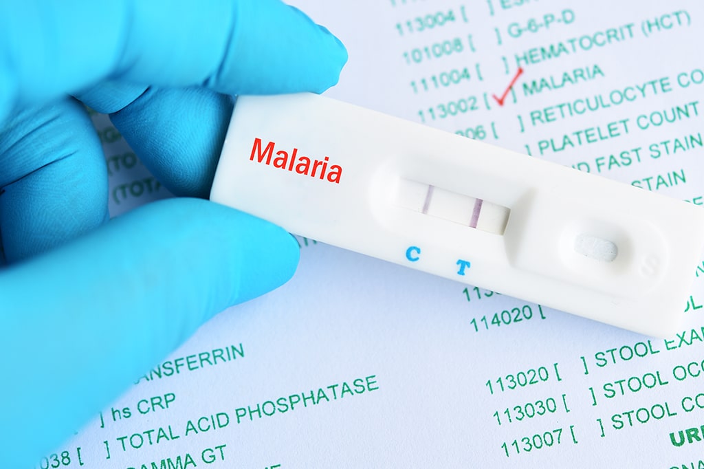 迅速検査カセットを用いたマラリア陽性検査結果